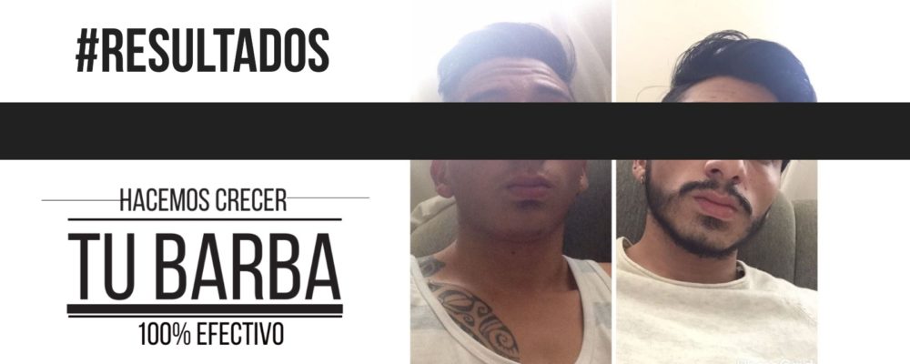 slider-pagina-web-13-1000x400 Barba León - Crecimiento de barba y bigote