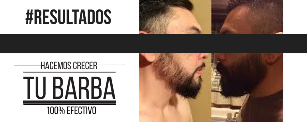 slider-pagina-web-14-1000x400 Barba León - Crecimiento de barba y bigote