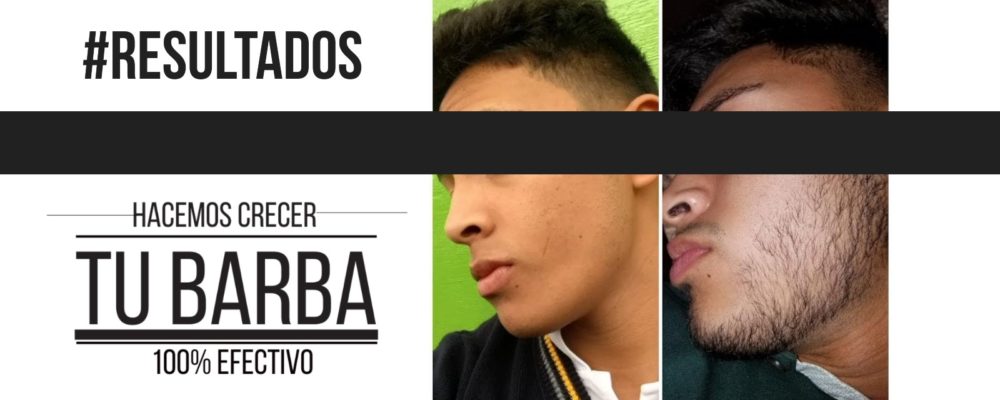 slider-pagina-web-15-1000x400 Barba León - Crecimiento de barba y bigote