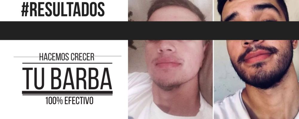 slider-pagina-web-16-1000x400 Barba León - Crecimiento de barba y bigote